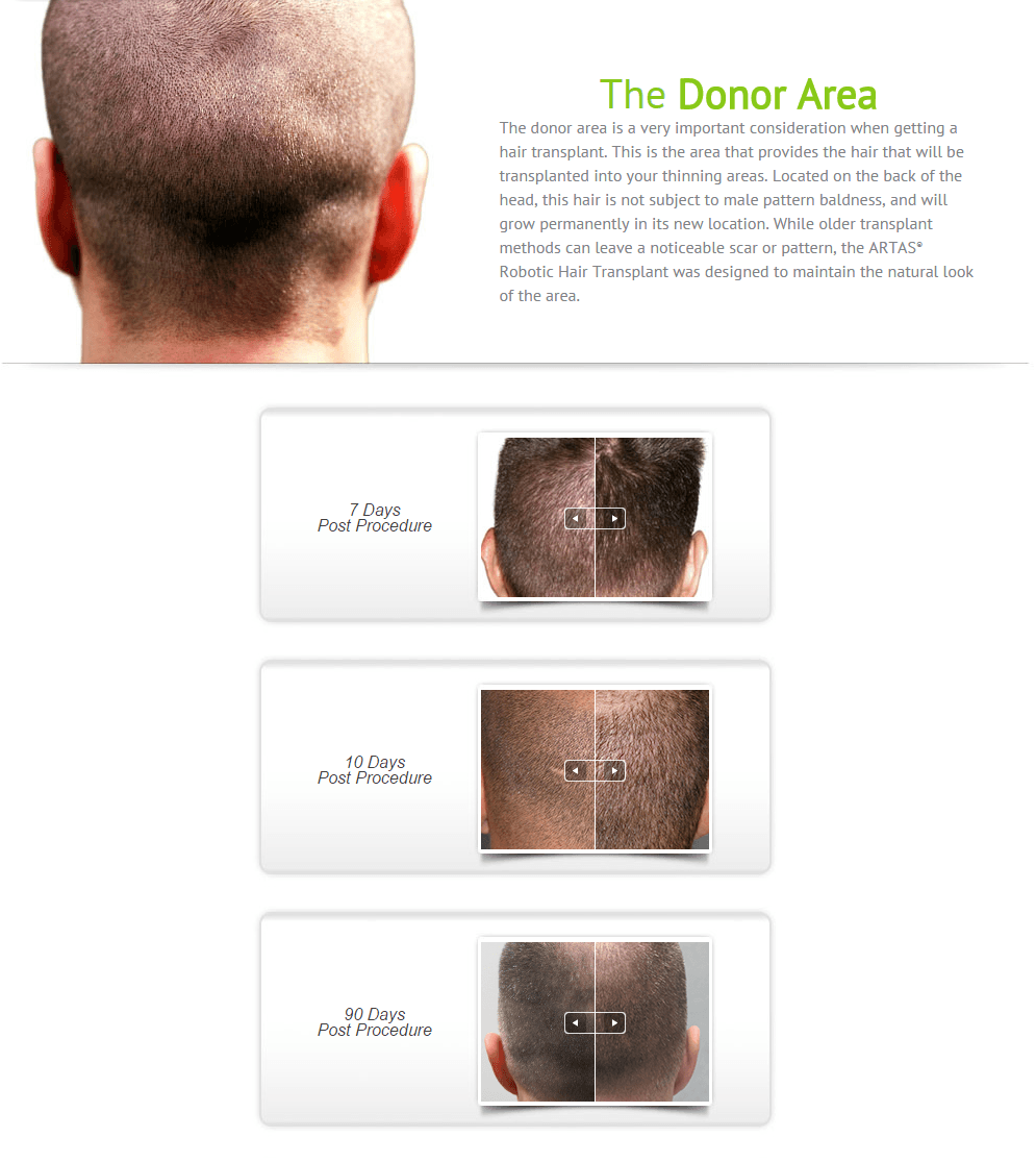 artas-info