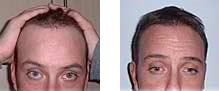 lee-purchase-before-after